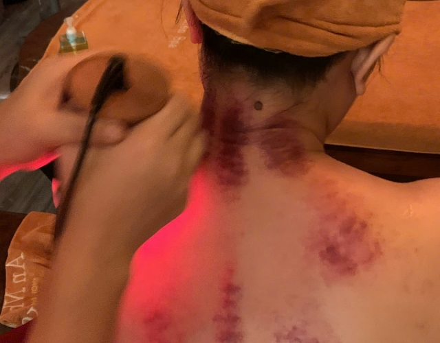 Địa Chỉ Trị Liệu Cổ Vai Gáy Đông Y Được Tin Tưởng Tại Dĩ An – An Nhiên Spa