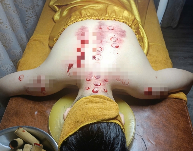 An Nhiên Spa: Địa Chỉ Trị Liệu Cổ Vai Gáy Uy Tín Tại Dĩ An