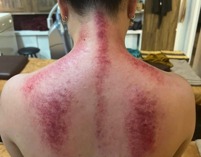 Spa Trị Liệu Cổ Vai Gáy Uy Tín Nhất Dĩ An – An Nhiên Spa