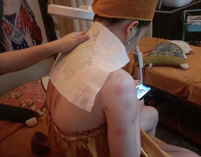 Dịch Vụ Trị Liệu Cổ Vai Gáy Tại An Nhiên Spa – Giải Pháp Cho Cuộc Sống Không Đau Mỏi