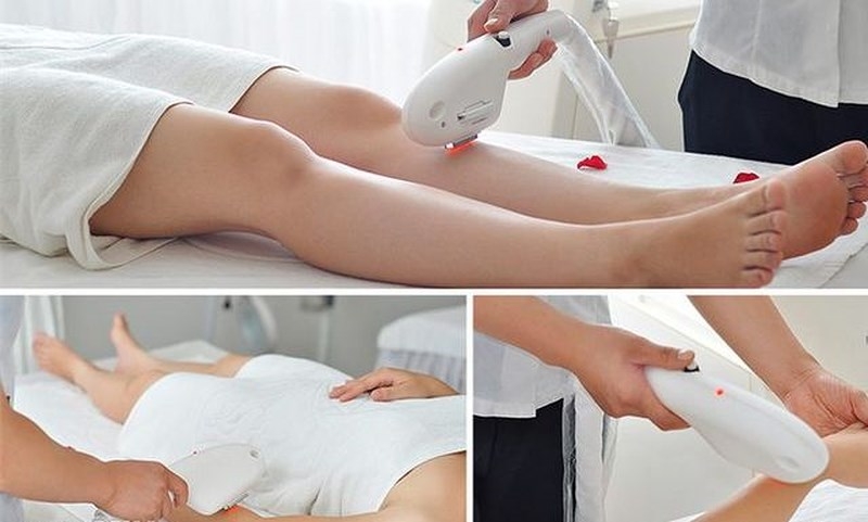 Những vùng cơ thể thường được lựa chọn để triệt lông