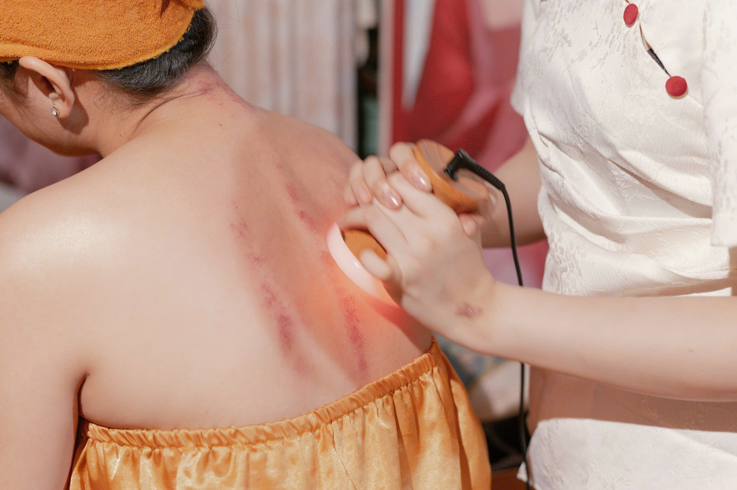 trị liệu vai gáy